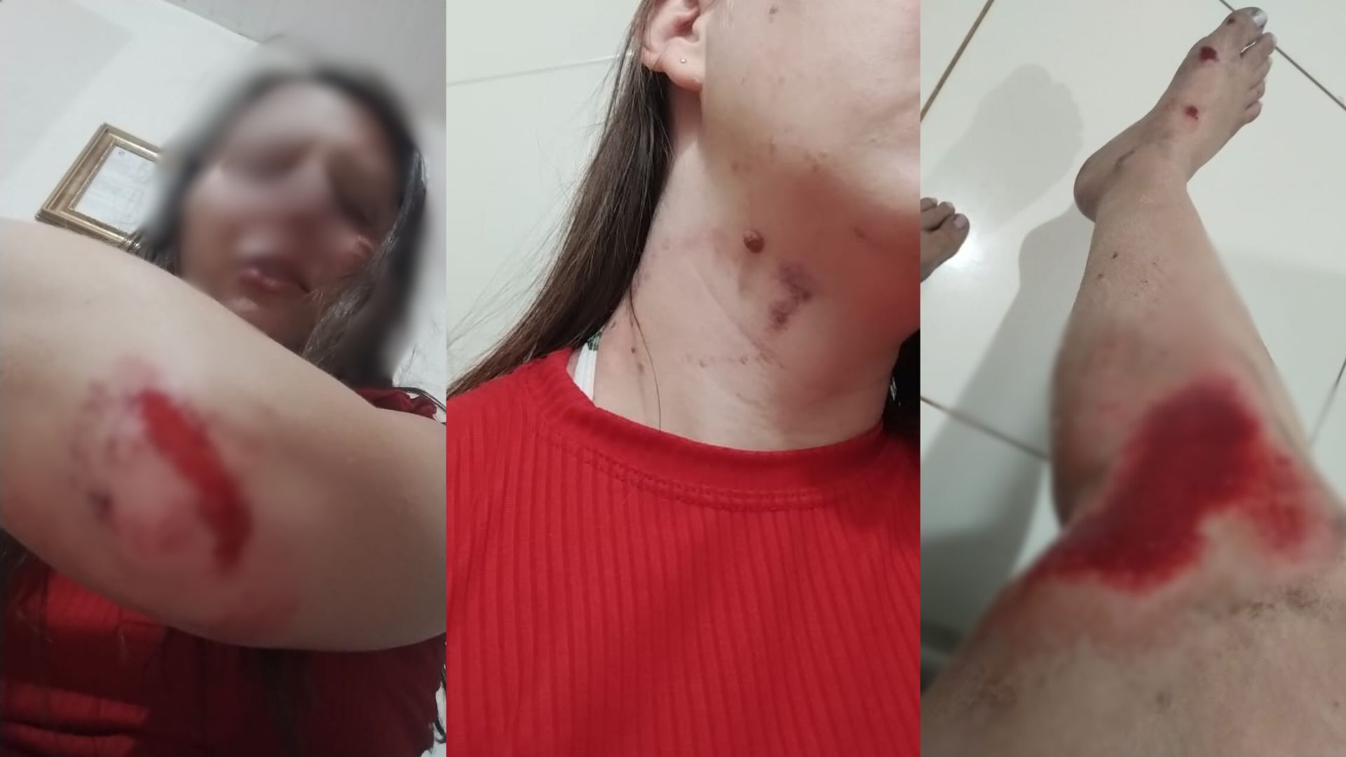 Para fugir de agressões do namorado, mulher se joga de carro em movimento em Terenos