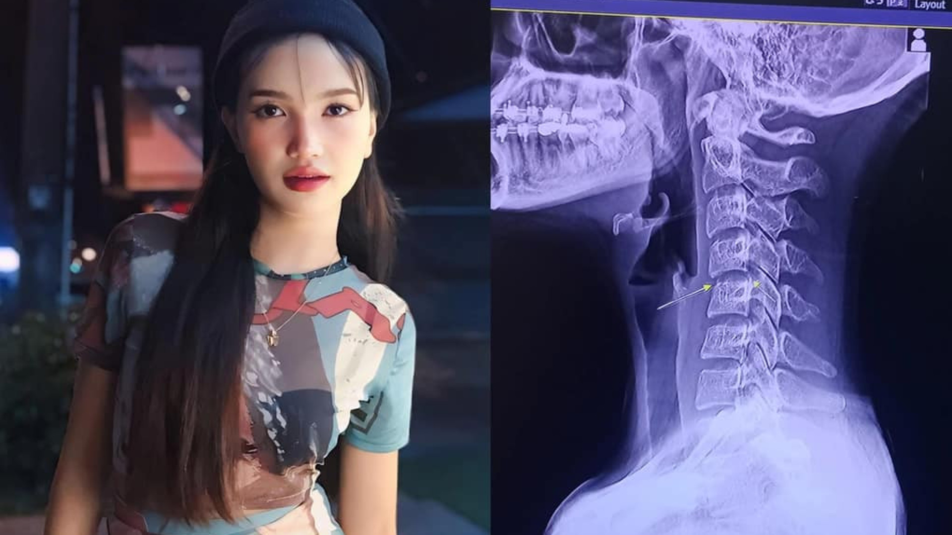 Jovem procura massagem para aliviar dor de pescoço e acaba morrendo